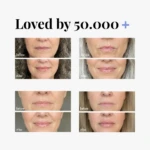 Extreme Lip Plumper - Raspberry